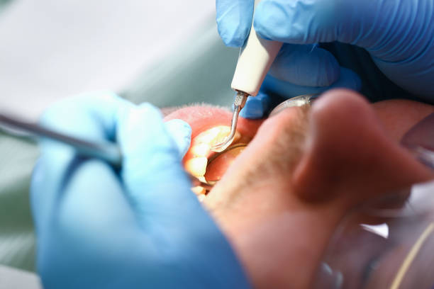 Best Emergency Broken Tooth Repair in National Harbor, MD
